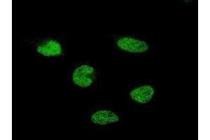 Immunofluorescence of monoclonal antibody to C11orf30 on HeLa cell. (EMSY antibody  (AA 1081-1178))