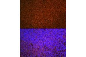 Immunofluorescence analysis of mouse spleen using SHIP11 Rabbit mAb (ABIN7267882) at dilution of 1:100 (40x lens). (INPP5D antibody)