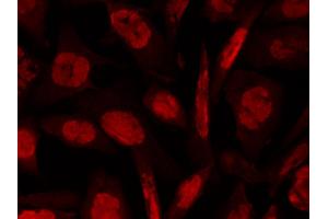 Immunofluorescence (IF) image for anti-Ataxia Telangiectasia Mutated (ATM) (AA 1974-1988), (pSer1981) antibody (ABIN6657494)