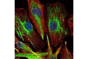 Immunofluorescence analysis of U251 cells using KLHL22 mouse mAb (green). (KLHL22 antibody)