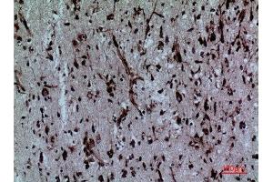 Immunohistochemistry (IHC) image for anti-Protein Disulfide Isomerase Family A, Member 3 (PDIA3) (Internal Region) antibody (ABIN6280937)