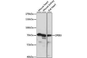 Western blot analysis of extracts of various cell lines, using CPEB3 antibody (ABIN7266666) at 1:1000 dilution. (CPEB3 antibody  (AA 150-400))