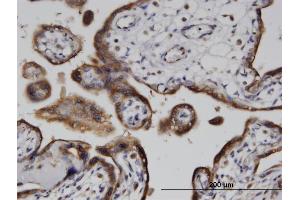 Immunoperoxidase of monoclonal antibody to ADPRH on formalin-fixed paraffin-embedded human placenta. (ADPRH antibody  (AA 23-121))