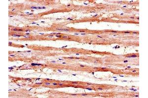 Immunohistochemistry of paraffin-embedded human heart tissue using ABIN7168345 at dilution of 1:100 (RBM4 antibody  (AA 121-205))