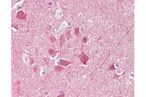 Anti-UCHL1 / PGP9. (UCHL1 antibody  (AA 50-100))