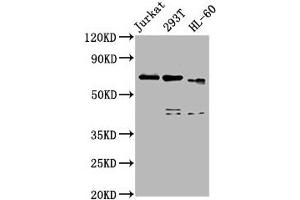 Western Blot Positive WB detected in: Jurkat whole cell lysate, 293T whole cell lysate, HL60 whole cell lysate All lanes: CBFA2T3 antibody at 5 μg/mL Secondary Goat polyclonal to rabbit IgG at 1/50000 dilution Predicted band size: 72, 63, 64, 8 kDa Observed band size: 72 kDa (CBFA2T3 antibody  (AA 39-159))