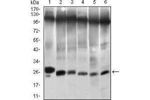 Western blot analysis using TWIST1 mouse mAb against NIH/3T3 (1), JURKAT (2), HELA (3), A549 (4), RAJI (5) and OCM-1 (6) cell lysate. (TWIST1 antibody  (AA 9-74))