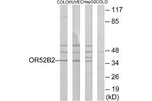 Western blot analysis of extracts from COLO cells, HUVEC cells and HepG2 cells, using OR52B2 antibody. (OR52B2 antibody  (Internal Region))