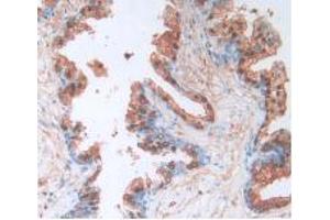 IHC-P analysis of Human Prostate Gland Tissue, with DAB staining. (Caspase 4 antibody  (AA 944-1148))