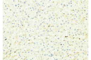 ABIN6275010 at 1/100 staining Mouse liver tissue by IHC-P. (CHSY1 antibody  (Internal Region))
