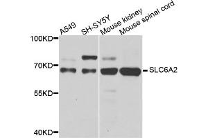 Western blot analysis of extracts of various cell lines, using SLC6A2 antibody (ABIN5974706) at 1/1000 dilution. (SLC6A2 antibody)