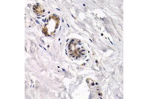 Immunohistochemistry of paraffin-embedded human normal breast using CAPN3 antibody at dilution of 1:200 (400x lens).