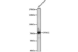 Western blot analysis of extracts of Mouse brain using CRTAC1 Polyclonal Antibody at dilution of 1:1000. (CRTAC1 antibody)