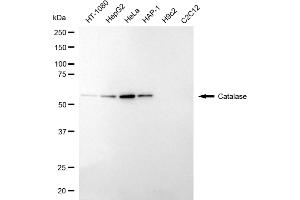 Western blotting analysis using catalase antibody (ABIN7797920). (Recombinant Catalase antibody)