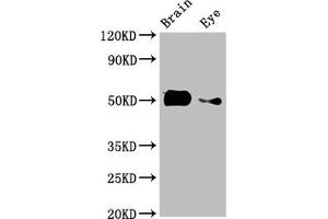 Western Blot Positive WB detected in: Zebrafish brain tissue, Zebrafish eye tissue All lanes: tuba8l2 antibody at 3 μg/mL Secondary Goat polyclonal to rabbit IgG at 1/50000 dilution Predicted band size: 51 kDa Observed band size: 51 kDa (tuba8l2 antibody  (AA 1-449))