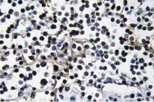 Immunohistochemistry (IHC) analyzes of PI 3-kinase p110alpha antibody in paraffin-embedded human lymph node tissue. (PIK3CA antibody)