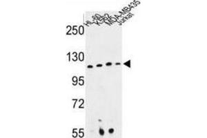 Western Blotting (WB) image for anti-Retinitis Pigmentosa GTPase Regulator Interacting Protein 1 (RPGRIP1) antibody (ABIN3003942) (RPGRIP1 antibody)