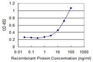Detection limit for recombinant GST tagged VIL1 is 0. (Villin 1 antibody  (AA 1-421))