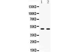Anti- E2F3 antibody, Western blotting All lanes: Anti E2F3  at 0. (E2F3 antibody  (C-Term))