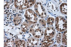 Immunohistochemical staining of paraffin-embedded liver tissue using anti-HDAC10mouse monoclonal antibody. (HDAC10 antibody)