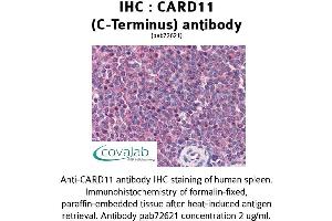 Image no. 1 for anti-Caspase Recruitment Domain Family, Member 11 (CARD11) (C-Term) antibody (ABIN1732635)
