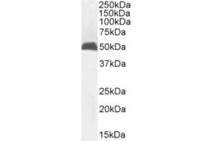 Western Blot using anti-MHC I antibody R1-21. (Recombinant MHC, Class I antibody)