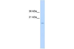 WB Suggested Anti-CENPA Antibody Titration:  1. (CENPA antibody  (N-Term))