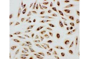 Immunohistochemistry (IHC) image for anti-Paxillin (PXN) (AA 456-472), (C-Term) antibody (ABIN3044187)