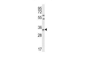 Western blot analysis in Jurkat cell line lysates (35ug/lane). (Elastase 3A antibody  (AA 157-186))