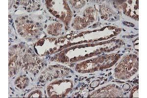 Immunohistochemistry (IHC) image for anti-V-Akt Murine Thymoma Viral Oncogene Homolog 1 (AKT1) antibody (ABIN1496558) (AKT1 antibody)