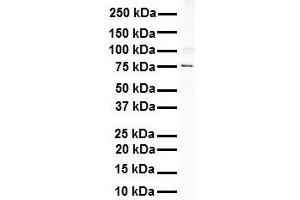 WB Suggested Anti-ITGB8 antibody Titration: 1 ug/mL Sample Type: Human Raji (ITGB8 antibody  (C-Term))
