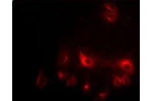 Immunofluorescent analysis of CCAR1 staining in HepG2 cells. (CCAR1 antibody)