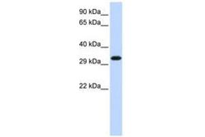 Image no. 1 for anti-Gem (Nuclear Organelle) Associated Protein 2 (GEMIN2) (C-Term) antibody (ABIN6740659) (SIP1 antibody  (C-Term))