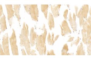 Detection of NOS2 in Human Skeletal muscle Tissue using Monoclonal Antibody to Nitric Oxide Synthase 2, Inducible (NOS2)