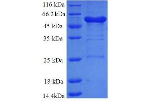 Annexin A6 (ANXA6) (AA 2-245), (partial) protein (GST tag)