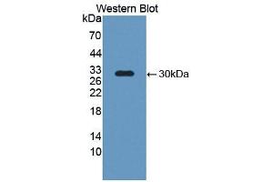 Western blot analysis of the recombinant protein. (NOS2 antibody  (AA 734-966))