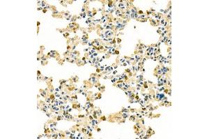 Immunohistochemistry analysis of paraffin embedded mouse lung using contactin-1 (ABIN7073572) at dilution of 1: 300 (Contactin 1 antibody)
