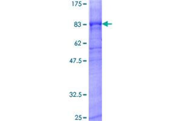 KCNJ6 Protein (GST tag)