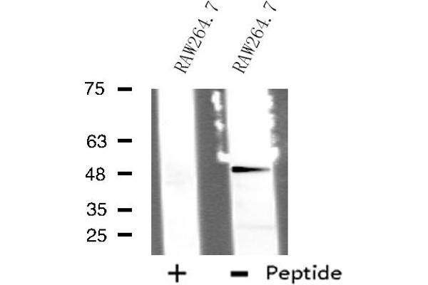 TTC23 antibody  (Internal Region)