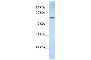 TRIM43 antibody used at 1 ug/ml to detect target protein.