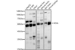 Western blot analysis of extracts of various cell lines, using HEXA antibody (ABIN6127520, ABIN6141731, ABIN6141733 and ABIN6221286) at 1:1000 dilution. (Hexosaminidase A antibody  (AA 270-529))