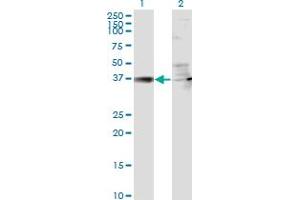 Western Blot analysis of RSAD2 expression in transfected 293T cell line by RSAD2 monoclonal antibody (M01), clone 4D10. (RSAD2 antibody  (AA 262-361))