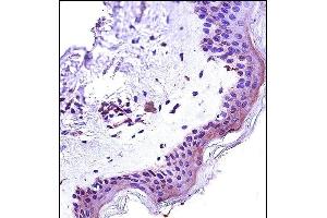 STAT2 Antibody (N-term) (ABIN657671 and ABIN2846664) immunohistochemistry analysis in formalin fixed and paraffin embedded human skin tissue followed by peroxidase conjugation of the secondary antibody and DAB staining. (STAT2 antibody  (N-Term))
