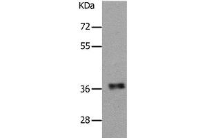 Western Blot analysis of Human fetal muscle tissue using PARD6A Polyclonal Antibody at dilution of 1:650