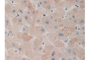 Detection of DRD1 in Human Liver Tissue using Polyclonal Antibody to Dopamine Receptor D1 (DRD1)