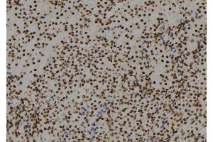 ABIN6279759 at 1/100 staining Mouse kidney tissue by IHC-P. (RGS22 antibody  (Internal Region))