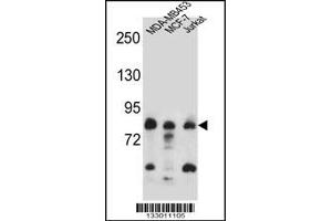 Western blot analysis in MDA-MB453,MCF-7,Jurkat cell line lysates (35ug/lane). (AFG3L2 antibody  (N-Term))