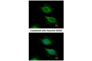 ICC/IF Image Immunofluorescence analysis of methanol-fixed HeLa, using ARF5, antibody at 1:500 dilution. (ARF5 antibody)