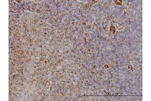 Immunoperoxidase of monoclonal antibody to PCDH8 on formalin-fixed paraffin-embedded human tonsil. (Protocadherin 8 antibody  (AA 32-120))