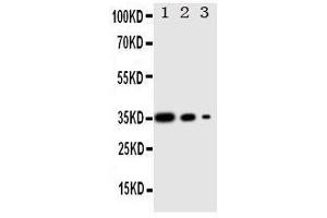 Western Blotting (WB) image for anti-Wingless-Type MMTV Integration Site Family, Member 2B (WNT2B) (AA 169-185), (Middle Region) antibody (ABIN3042967) (WNT2B antibody  (Middle Region))